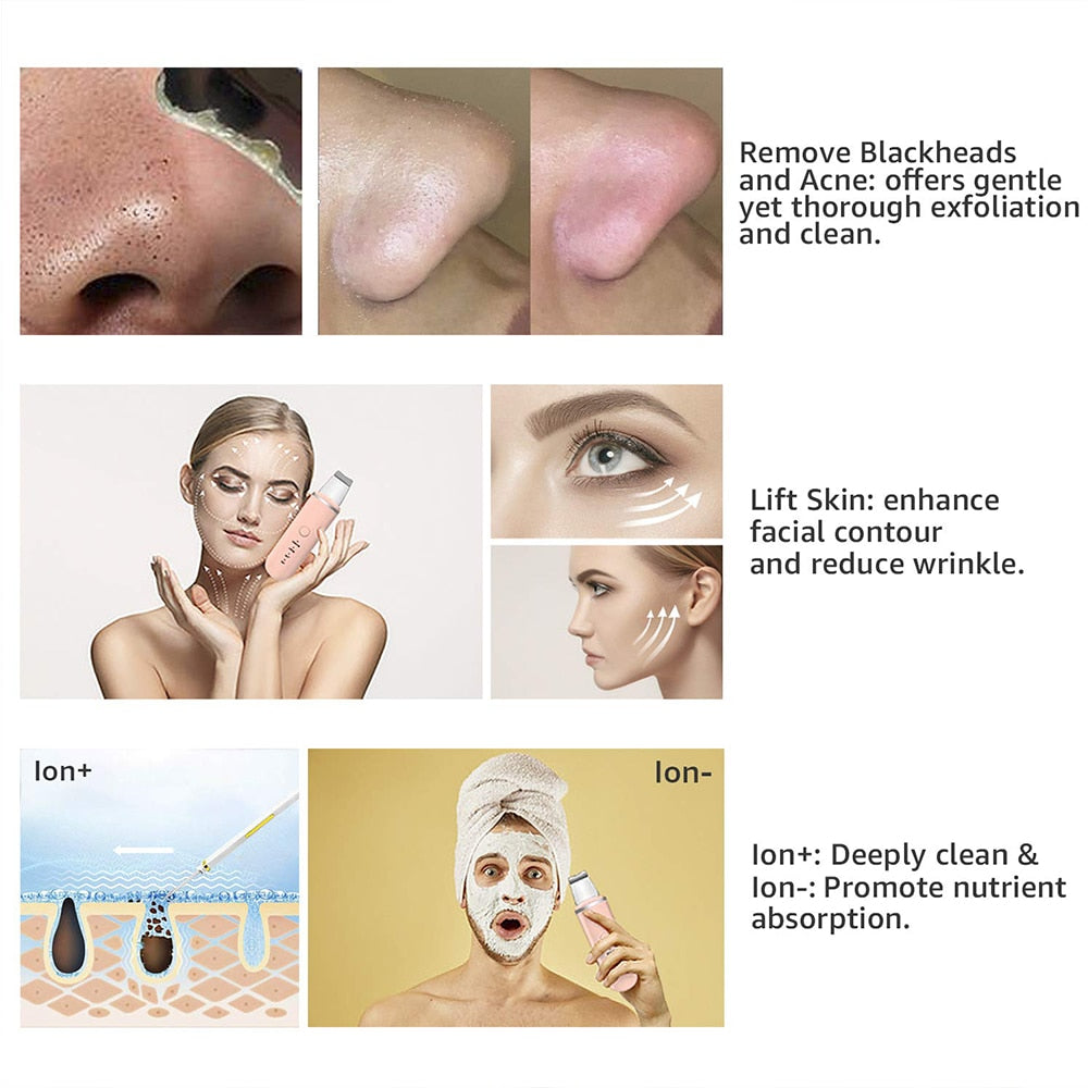 LumaDerm Ultrasonik Siyah Nokta Temizleyici Cilt Peeling Cihazı