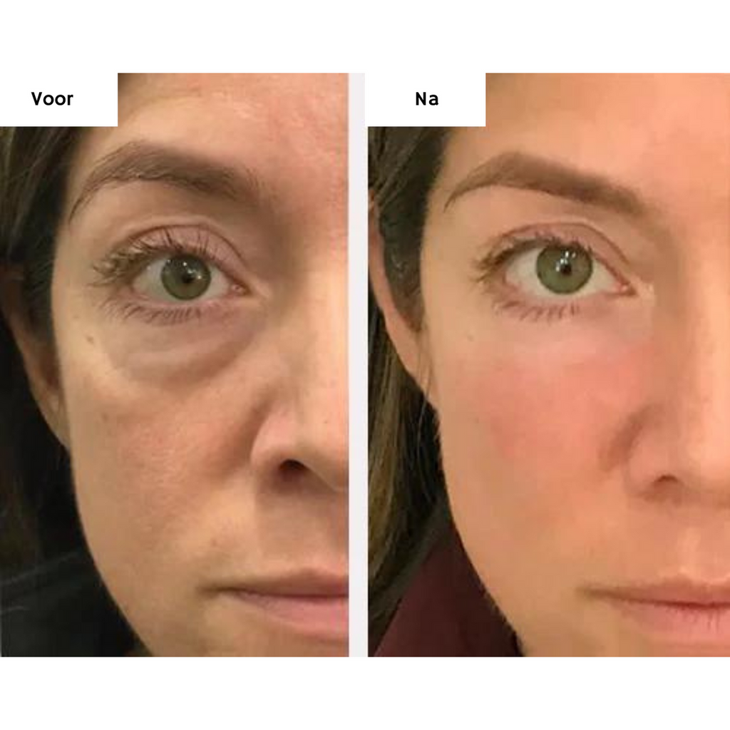 EyeGlow | Reduce Dark Circles Instantly