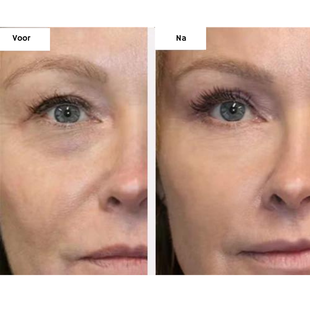 EyeGlow | Reduce Dark Circles Instantly
