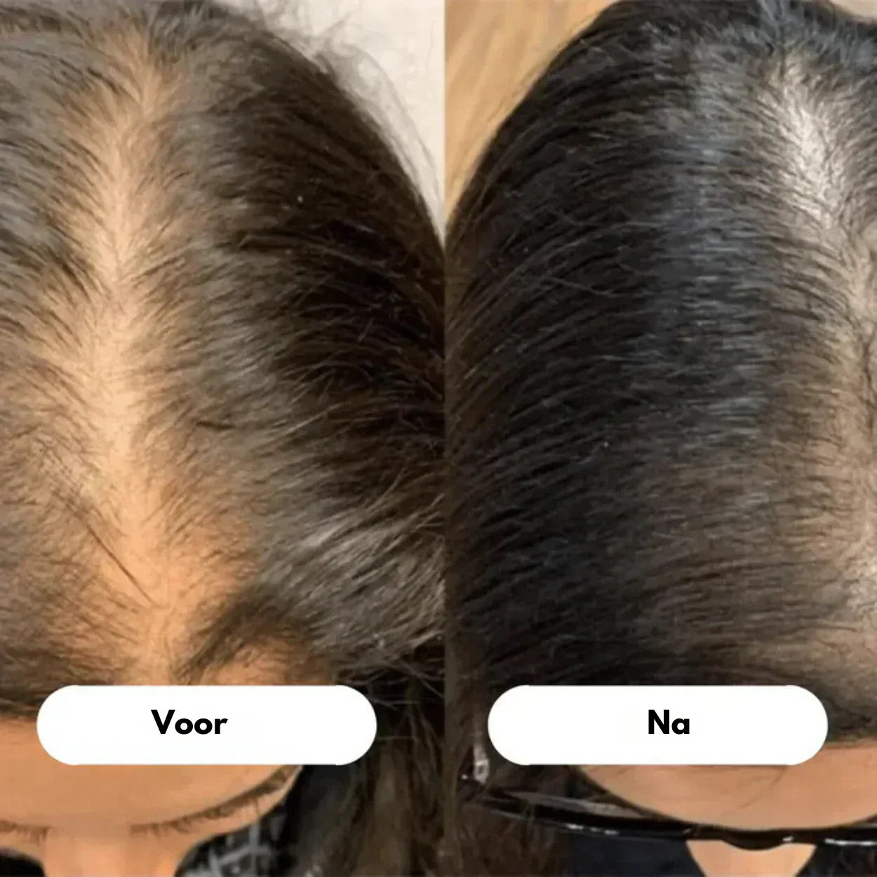 RadiantRoots | Scopri capelli più folti con il pettine per la crescita dei capelli a LED