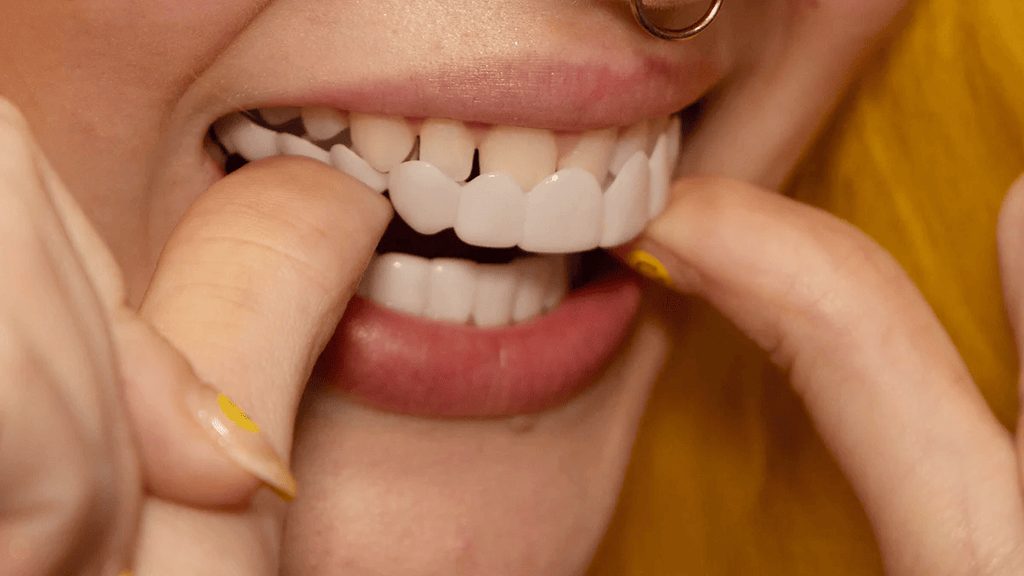 Snap on Smile Veneers (Övre & Nedre)