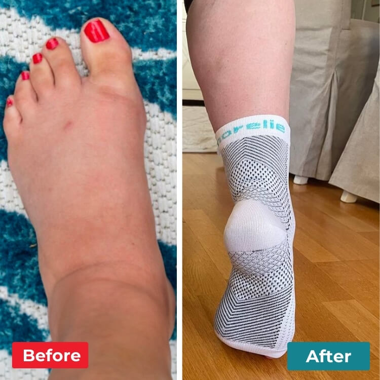 Step Relief - Vivez des journées sans douleur sans traitements coûteux ni visites chez le médecin…