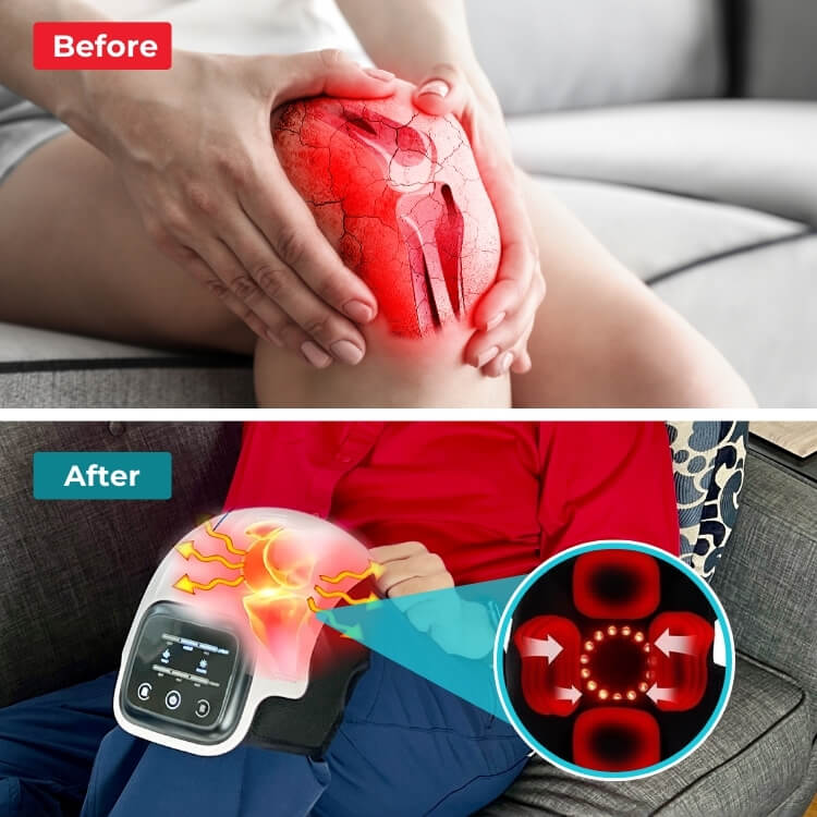 Knee Relieve™ 3 az 1-ben térd masszírozó