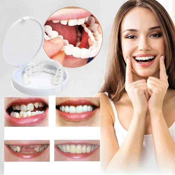 Snap on Smile Veneers (Övre & Nedre)