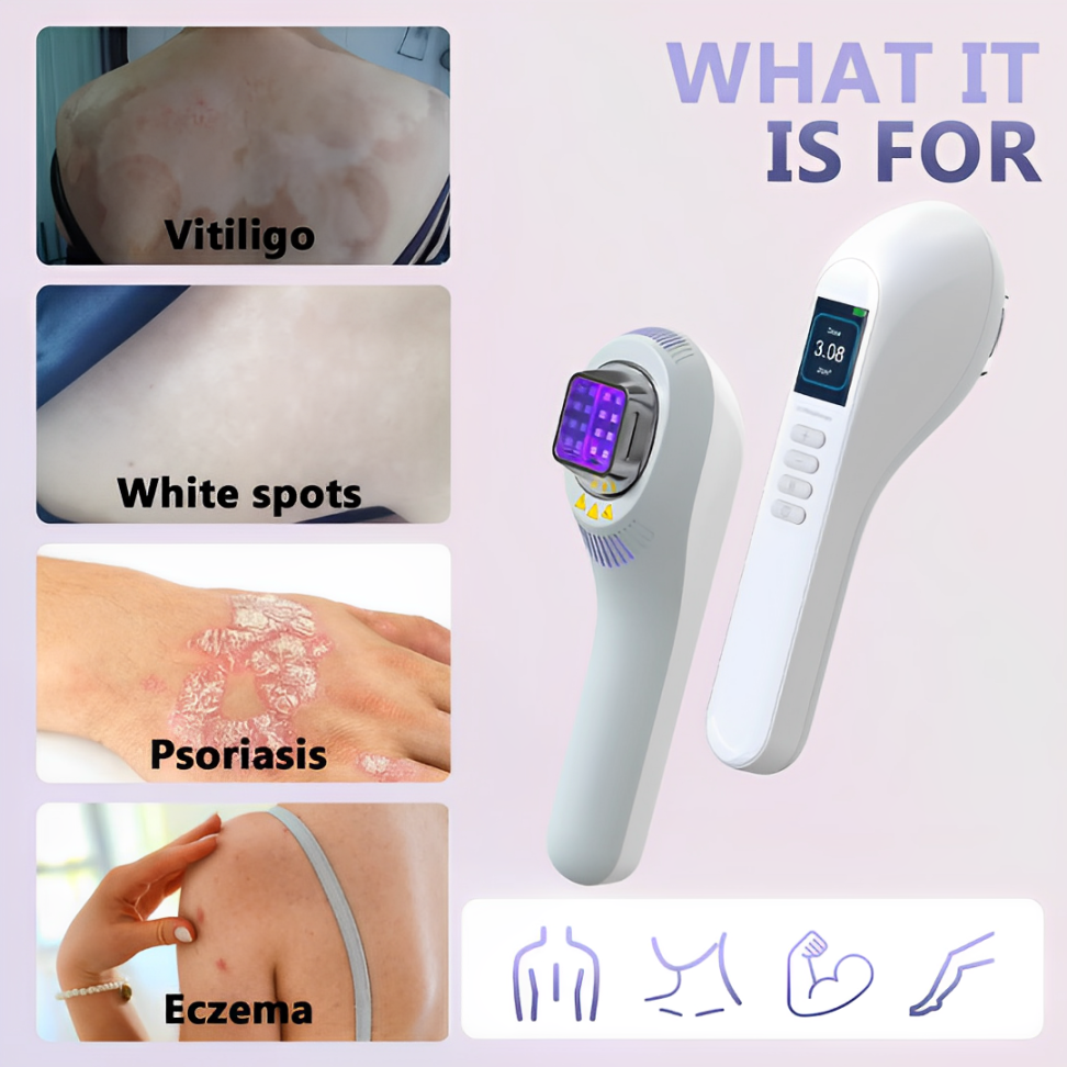 LumaLight 308nm UVB Fototherapie Lamp voor Vitiligo en Psoriasis