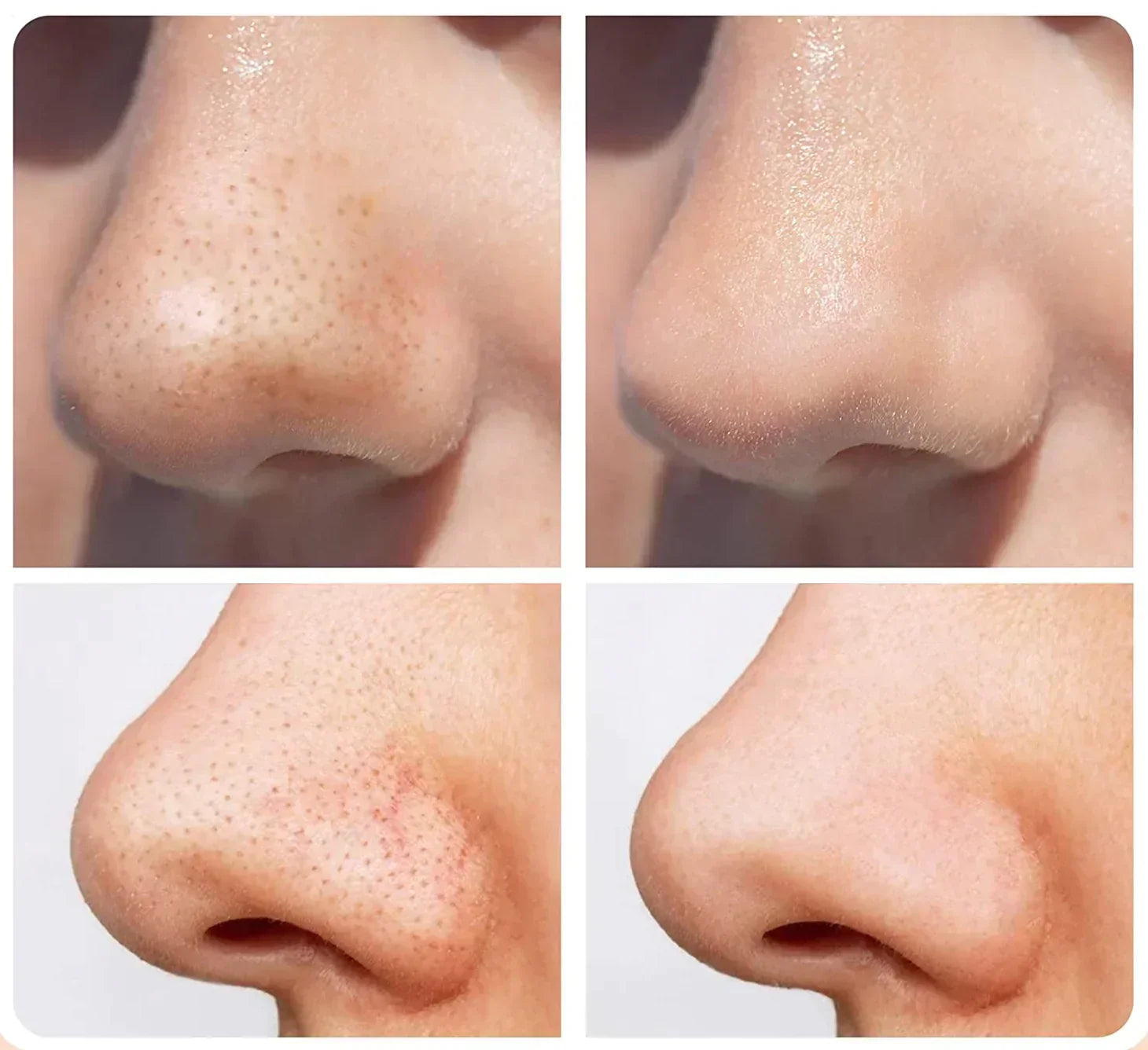 Comforth MicroDerm - Személyes gyémántcsiszolás - gyémánt felületkezelés/fekete pont eltávolító