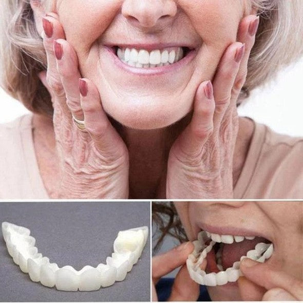 BrightSmile Veneers Set mit Ober- und Unterkiefer inklusive