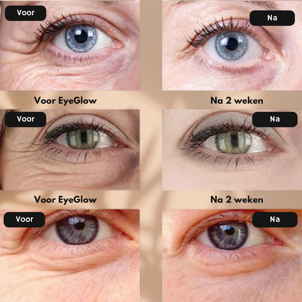 EyeGlow | Reduce Dark Circles Instantly