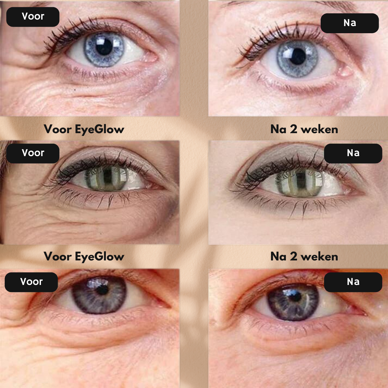 EyeGlow | Reduce Dark Circles Instantly