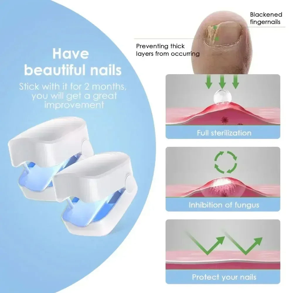 Appareil Laser de Nettoyage contre le Champignon des Ongles - Dispositif Révolutionnaire Expert de Thérapie par Lumière à Haute Efficacité pour les Maladies des Ongles des Pieds