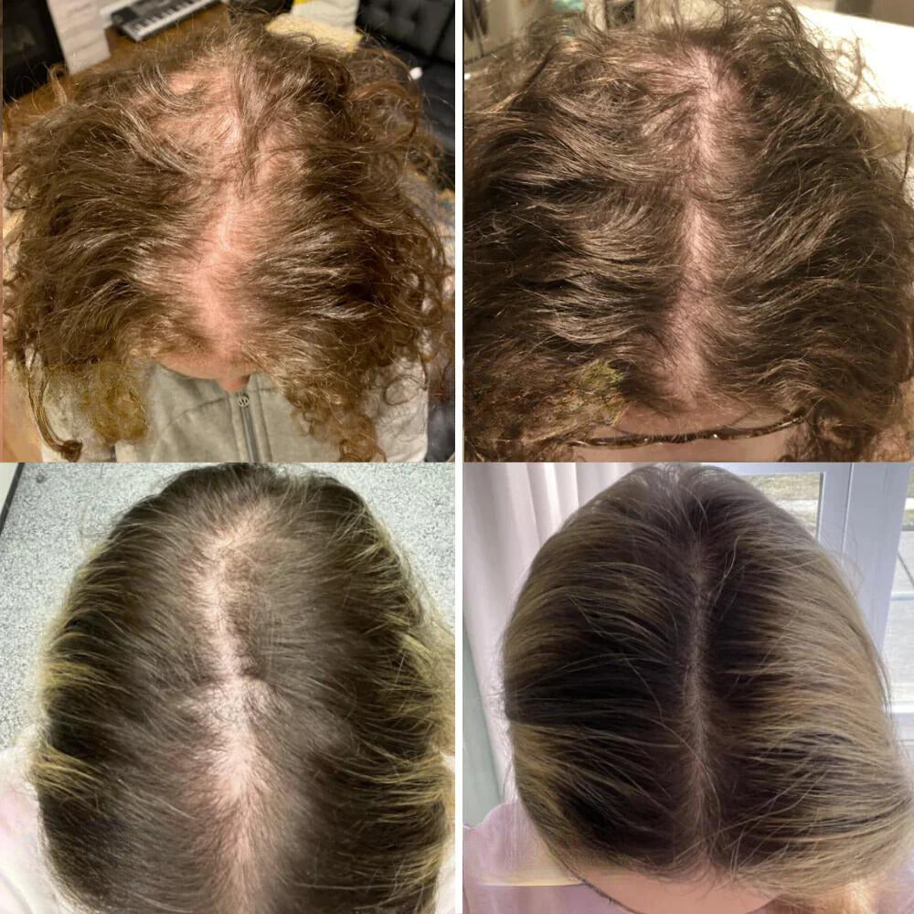 ليورا | زيت نمو الشعر الطبيعي | أورنتلي