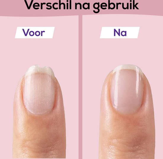Trygt neglefilsett