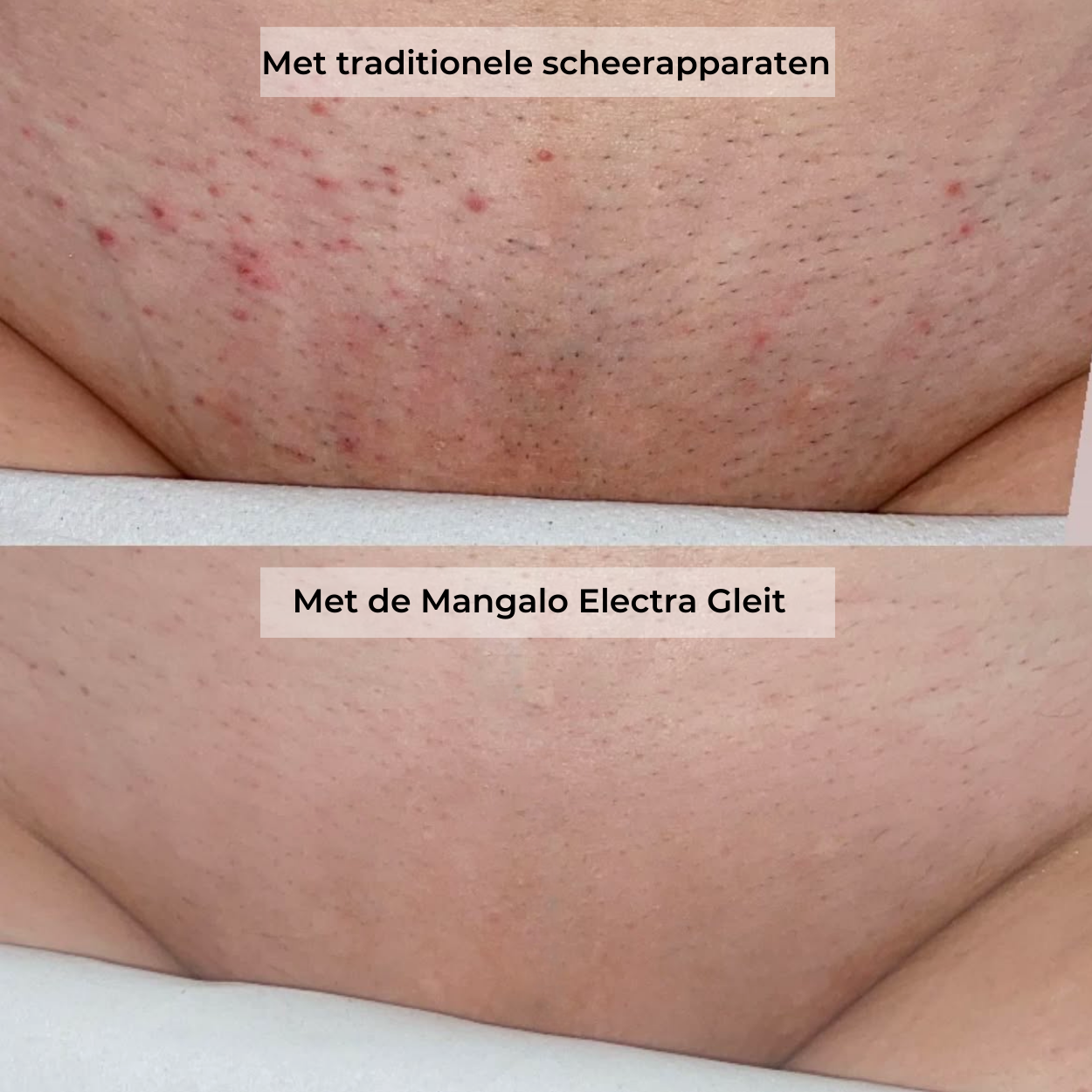 Vrimlo Electra Barbermaskine | Alt-i-en Kvindelig Barbermaskine