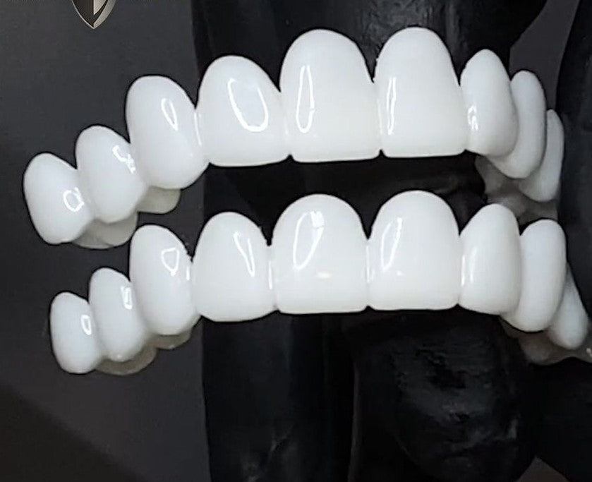 BrightSmile 快速贴合美容贴面 即刻遮盖瑕疵的微笑