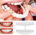 BrightSmile Veneers Set mit Ober- und Unterkiefer inklusive