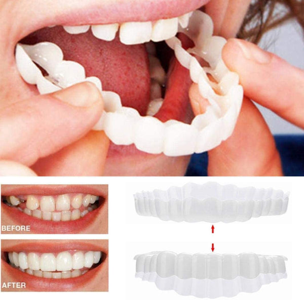 BrightSmile Veneers Set mit Ober- und Unterkiefer inklusive