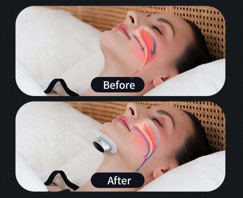 NovaRest Aide Intelligente pour l'Apnée du Sommeil Édition Pro Premier