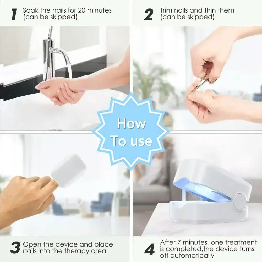 Appareil Laser de Nettoyage contre le Champignon des Ongles - Dispositif Révolutionnaire Expert de Thérapie par Lumière à Haute Efficacité pour les Maladies des Ongles des Pieds