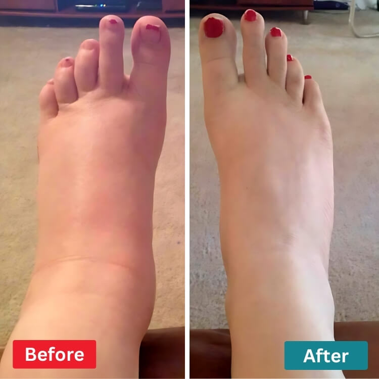 Feet Relive NMES Ayak Masaj Aleti