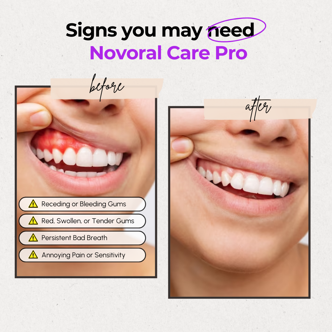 Soin Buccal Pro - Thérapie des Gencives et Parodontale