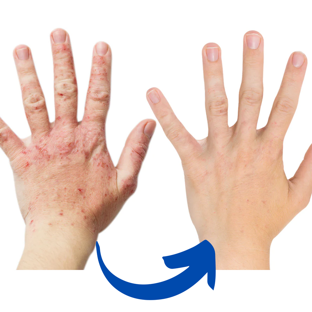 Gants de thérapie par lumière rouge pour l'arthrite, soulagement de la douleur du poignet et de la main, proche infrarouge