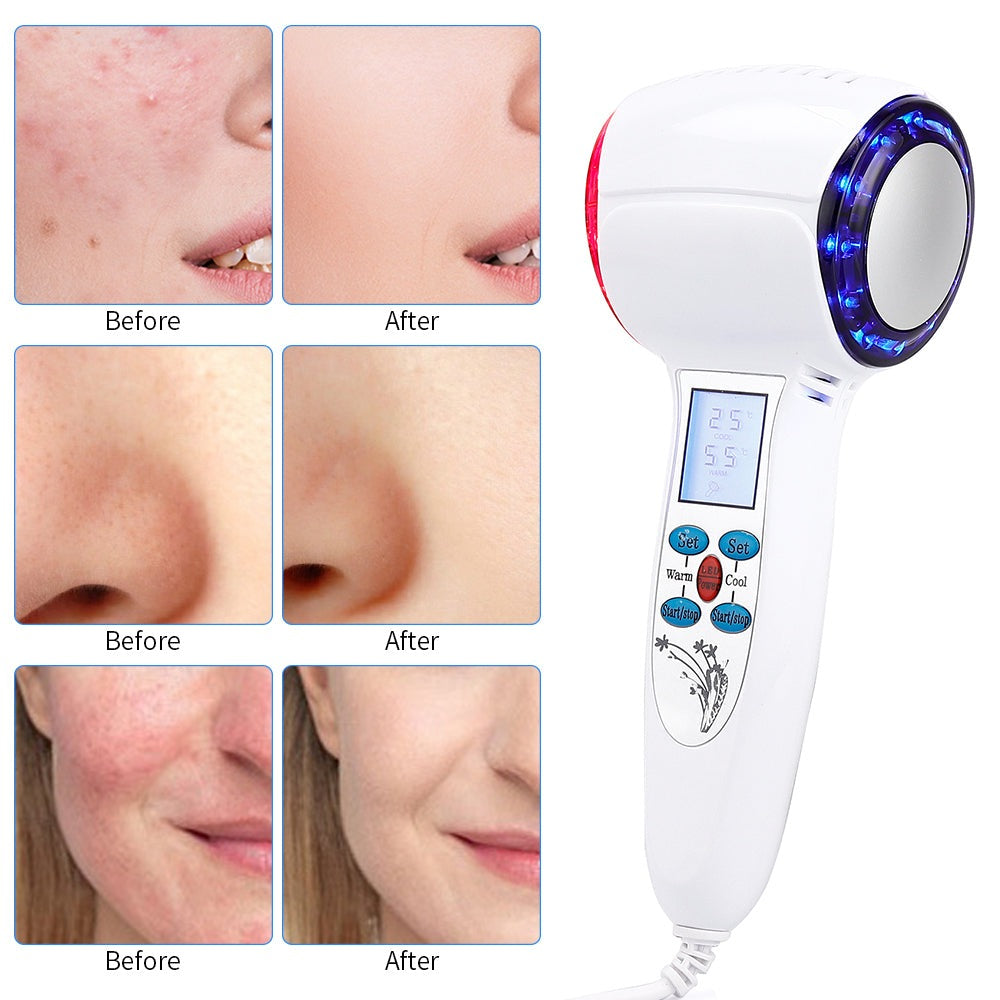 CryoGlow Gezichtscryotherapieapparaat voor Thuisgebruik