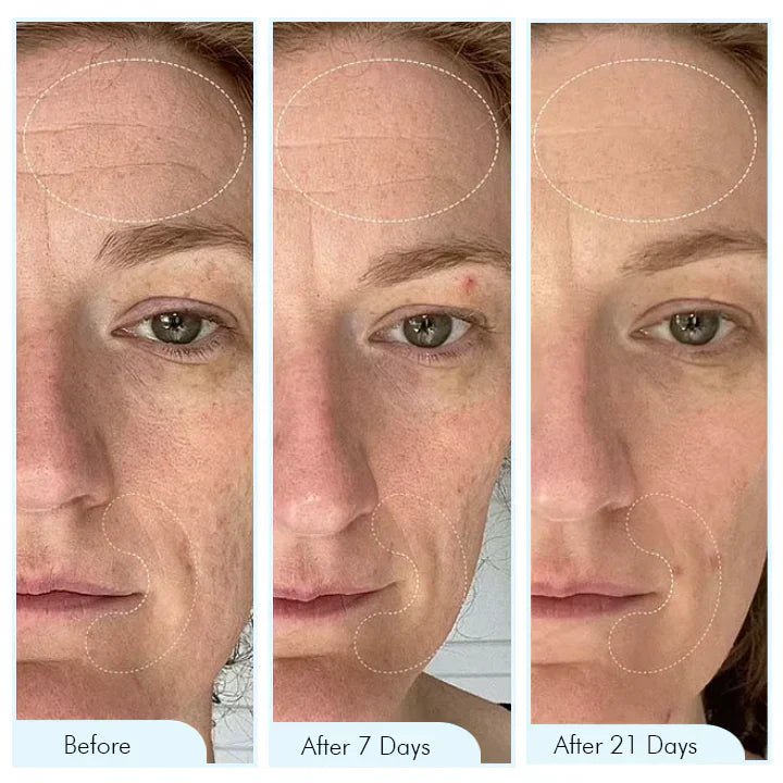 EELHOE™ Korejska bio-kolagenska maska