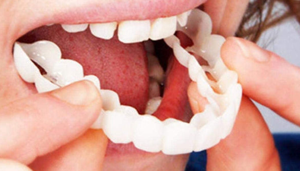 Σετ όψεων BrightSmile με άνω και κάτω γνάθο