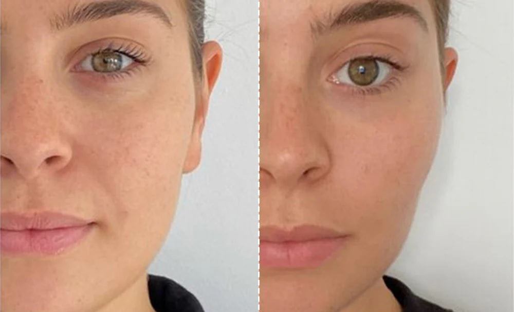 Masque de tonification et de lifting facial EMS