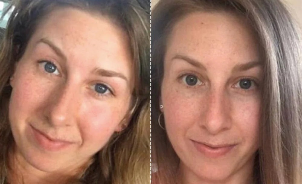 Masque de tonification et de lifting facial EMS