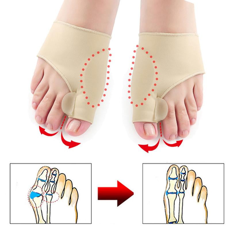 Lengan Pembetul Ortopedik Benjolan OrthoStride (1 Pasang)