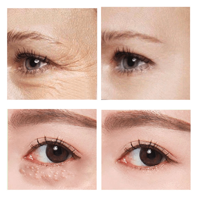 Eye Fix rapide - crème contour des yeux à action rapide et raffermissante