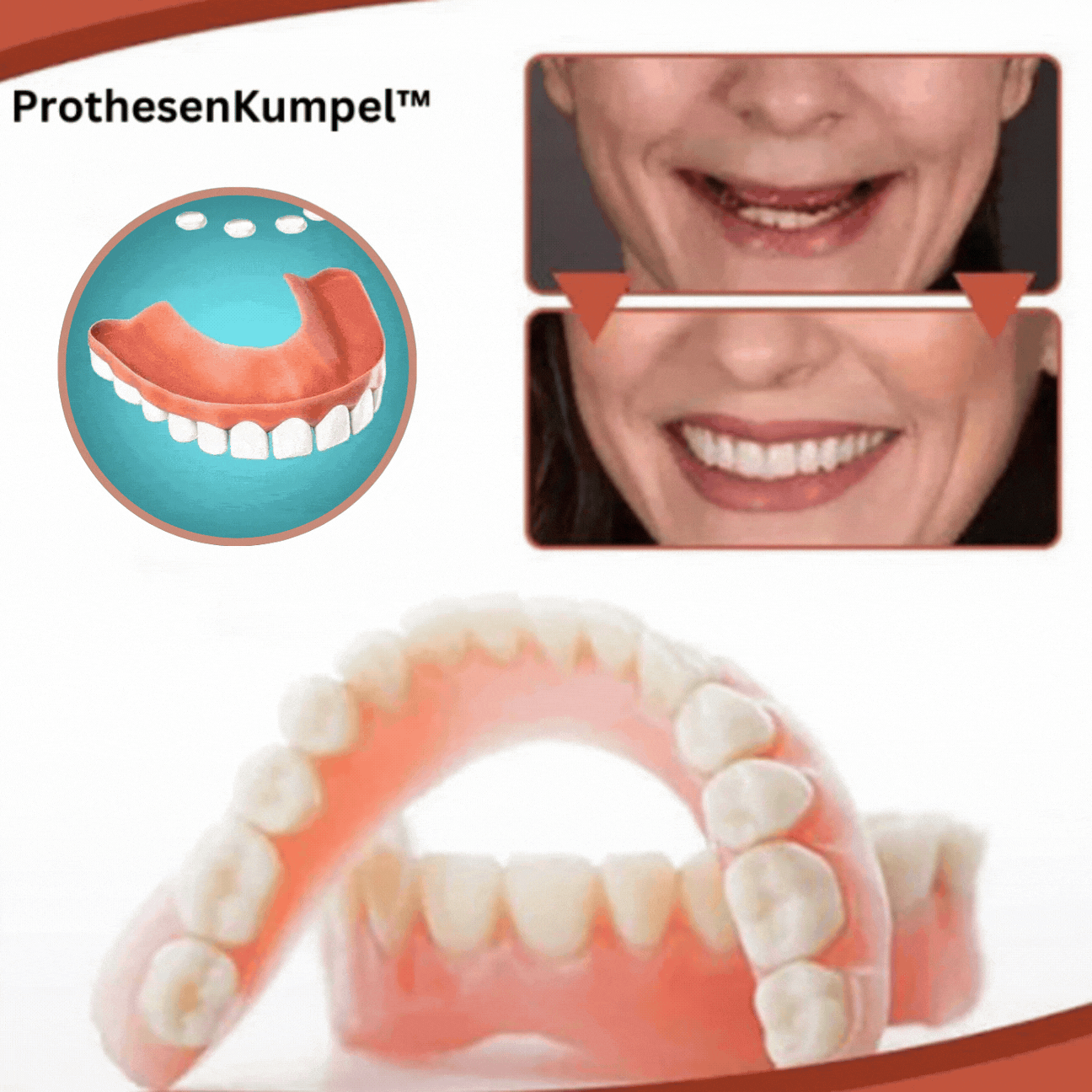 Set Prostesis Silikon Biokompatibel GlowSmile untuk Keselesaan Tanpa Sakit dan Senyuman Semula Jadi