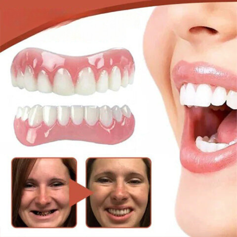 Set Prostesis Silikon Biokompatibel GlowSmile untuk Keselesaan Tanpa Sakit dan Senyuman Semula Jadi