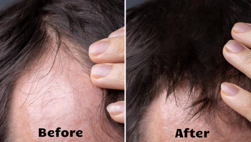 Thérapie lumineuse RadiantGlow pour des cheveux plus épais, plus fournis et plus sains en 10 minutes par jour