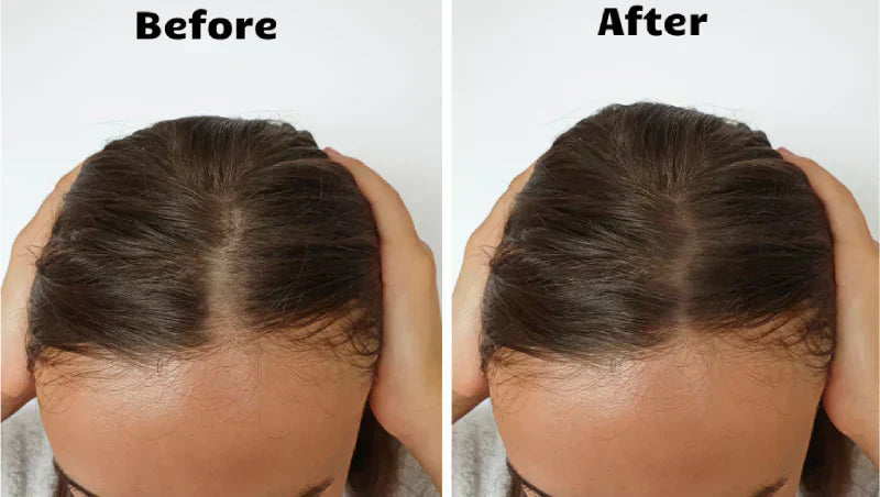 Thérapie lumineuse RadiantGlow pour des cheveux plus épais, plus fournis et plus sains en 10 minutes par jour