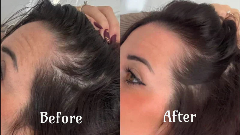 Thérapie lumineuse RadiantGlow pour des cheveux plus épais, plus fournis et plus sains en 10 minutes par jour