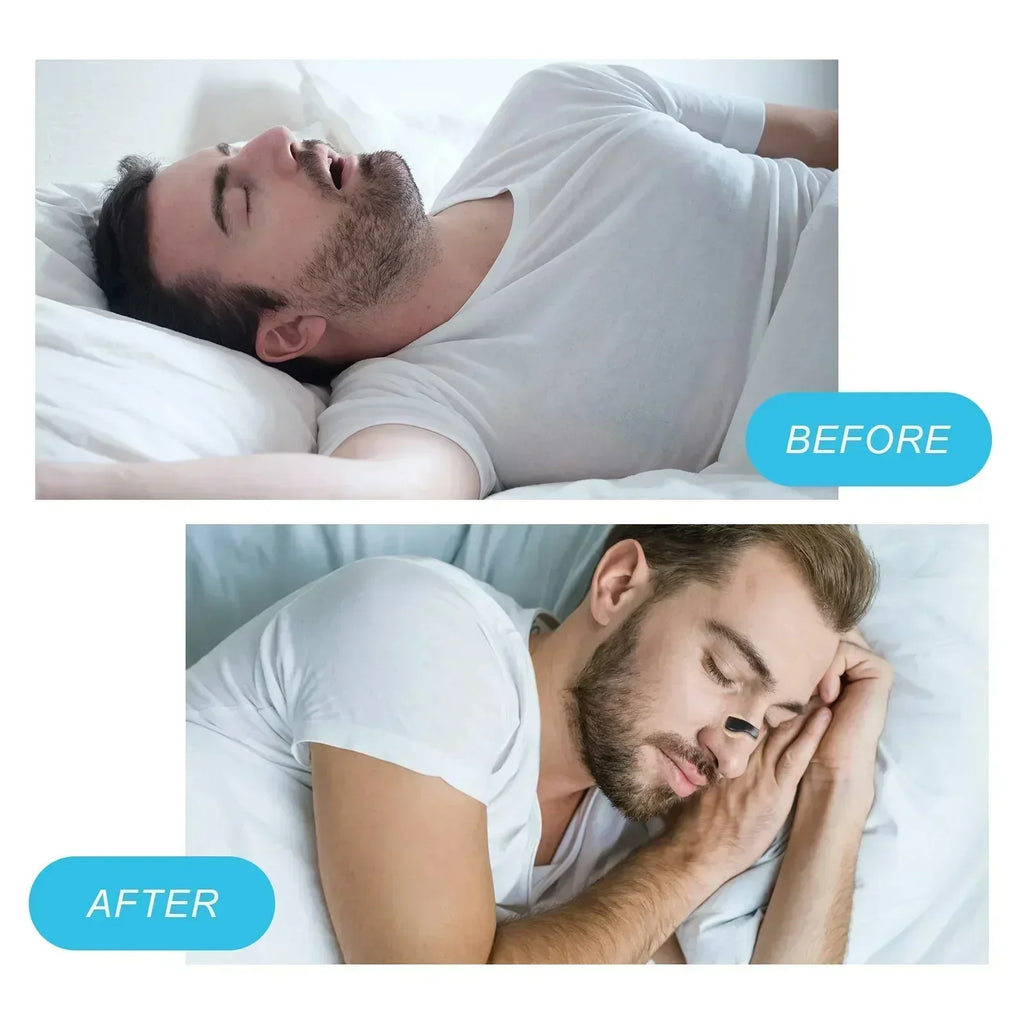Clip nasal magnétique anti-ronflement | Meilleur sommeil et respiration facile ! 🌙