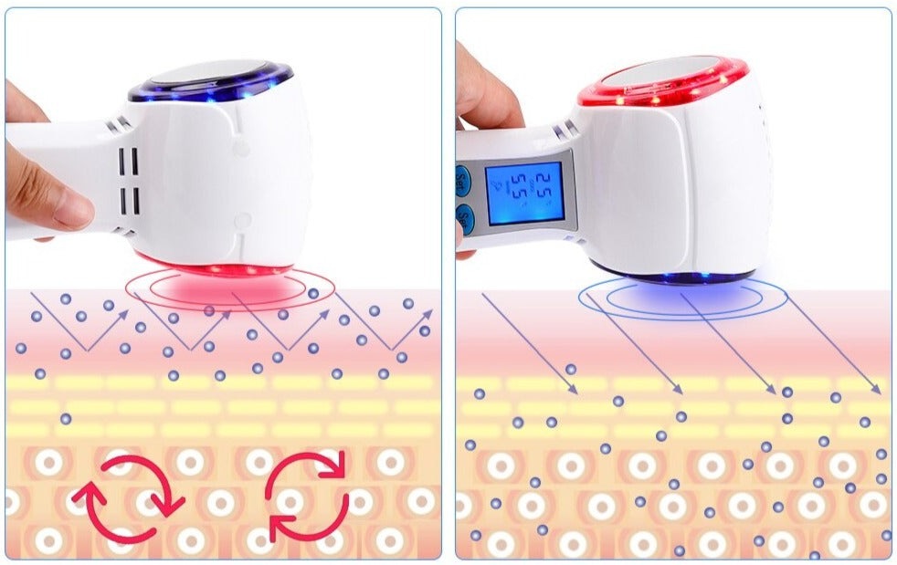 CryoGlow Gezichtscryotherapieapparaat voor Thuisgebruik