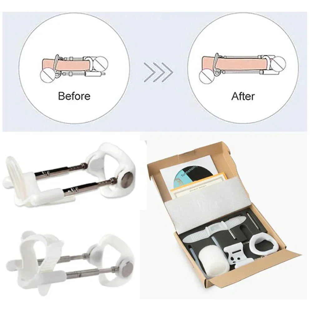 מתקן מתיחה להגדלת גודל זכר - מתקן מתיחה להארכה