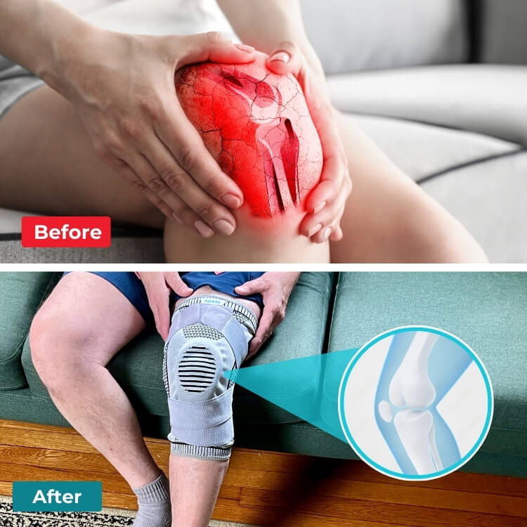 Active Knee - Kompressziós Támogatás