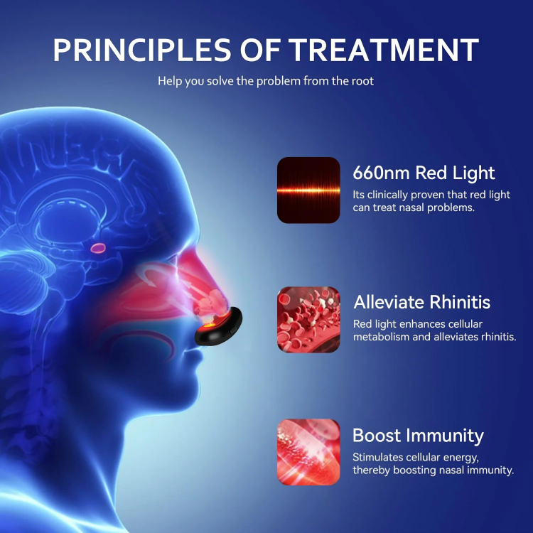 Traitement de la rhinite allergique avec appareil de thérapie par lumière rouge nasale