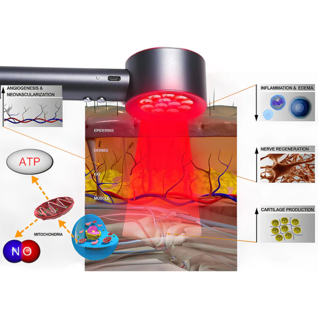 Dispositivo portatile per terapia con luce rossa e blu Migliore per terapia laser a bassa intensità a casa