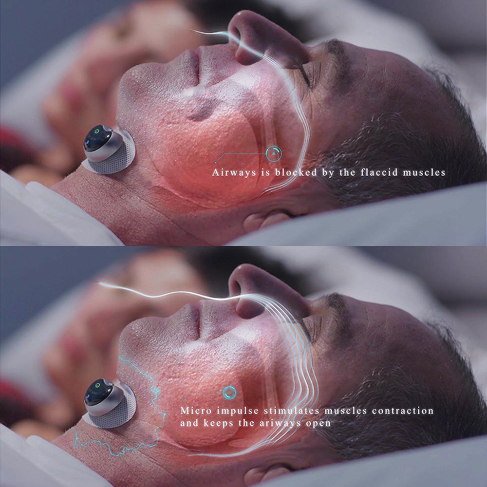 NovaSleep Slimme Snurkstopper Pro Reeks Nieuwe Editie