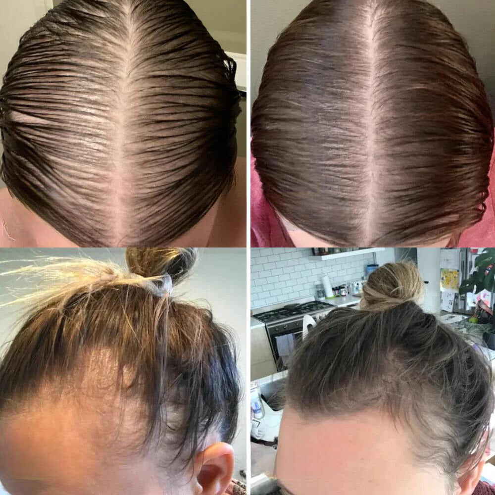 Liora | ナチュラルヘアグロースオイル | Orntli