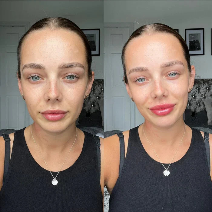 סרום מיידי למילוי שפתיים