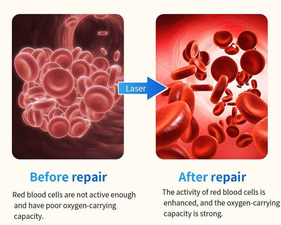 SugaCare Pro okosóra | Nem invazív glükózmonitor