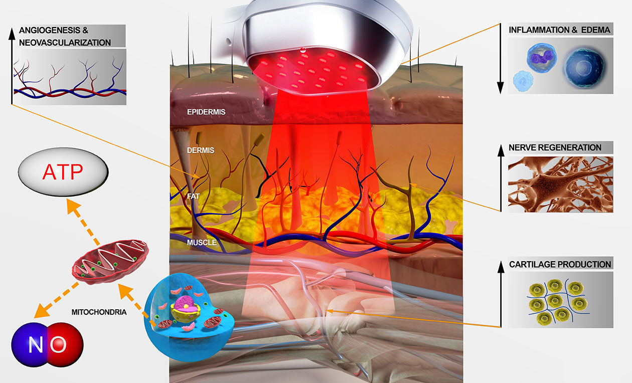 Dispositivo di terapia a luce rossa laser fredda migliorato LumaPulse