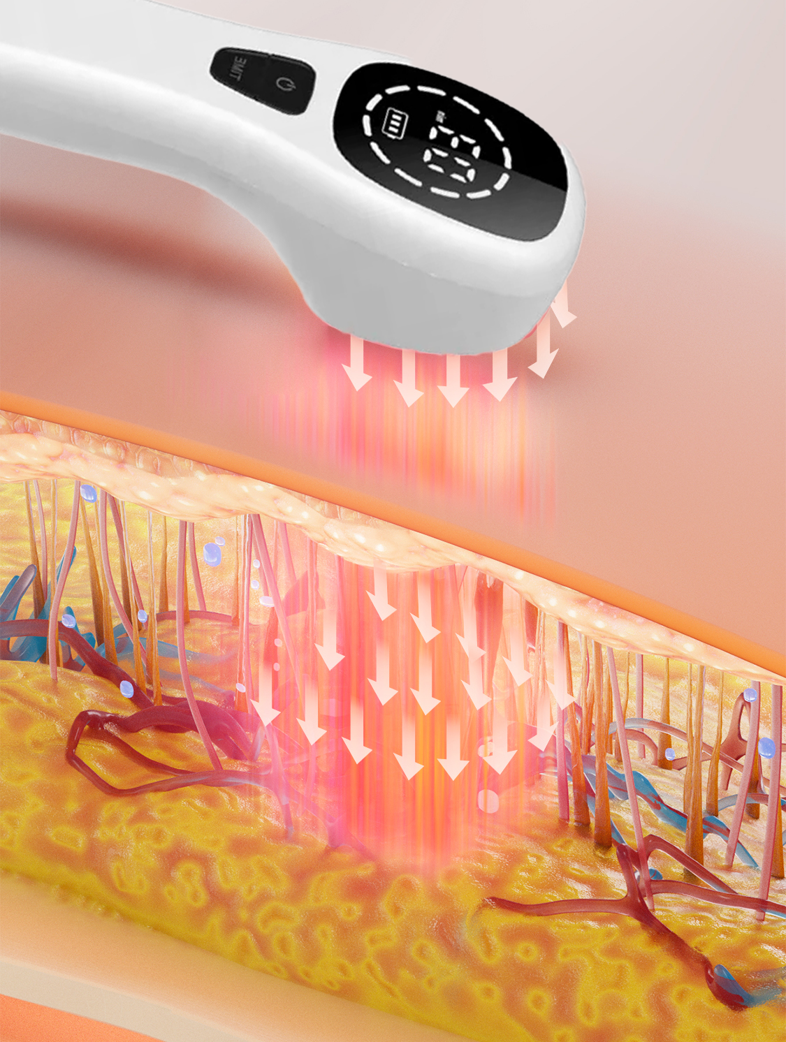 Dispositivo di terapia a luce rossa laser fredda migliorato LumaPulse