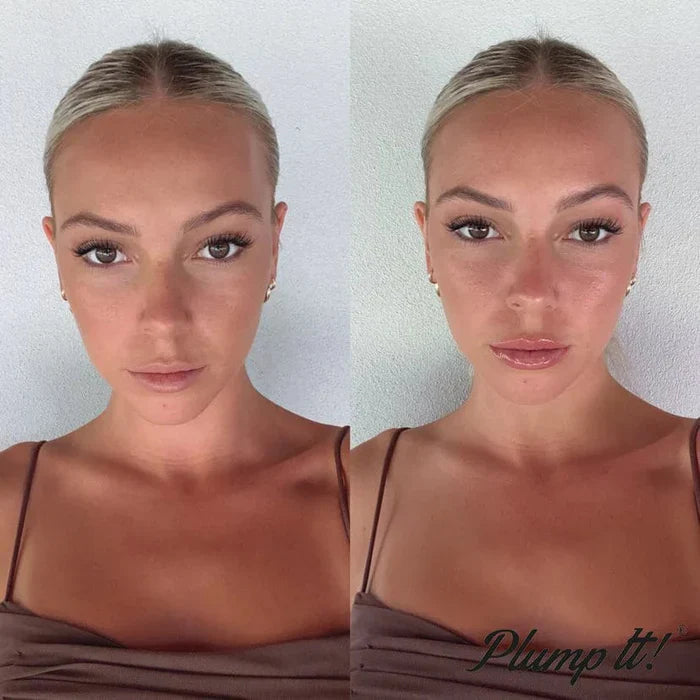 סרום מיידי למילוי שפתיים